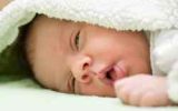 علائم زردی نوزاد