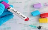 اطلاعات کامل در مورد آزمایش rbc یا گلبول های قرمز