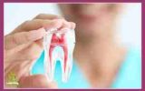 درمان درد دندان عفونی با روش خانگی و علمی